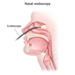 nasal endoscopy