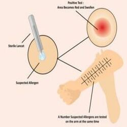 best ent specialist in bangalore