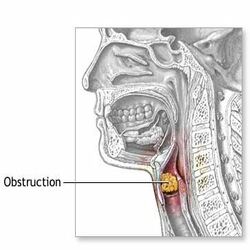 throat pain symptoms