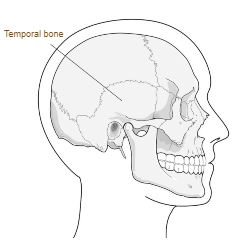 temporal bone